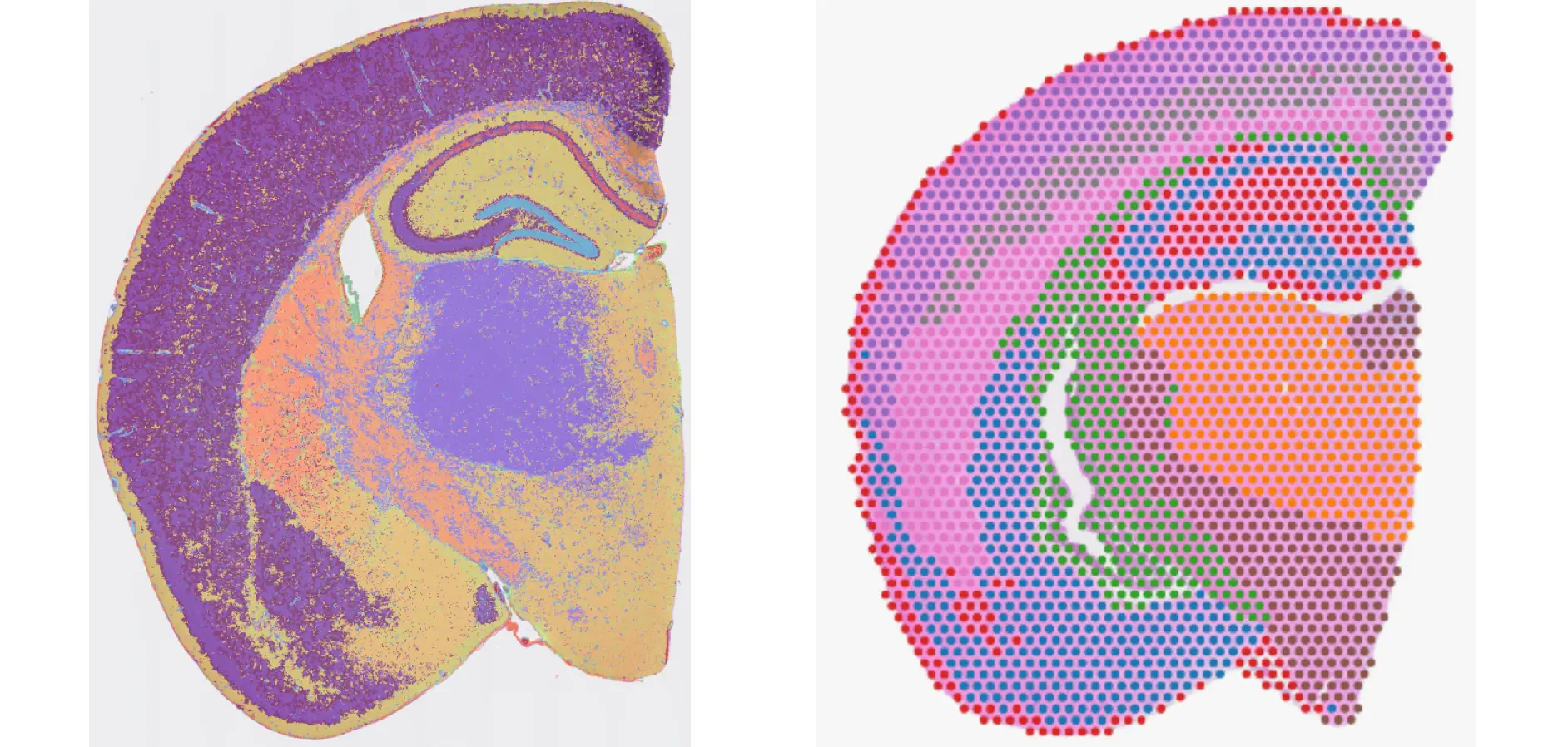 Visium and Visium HD mouse brain