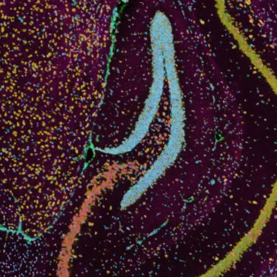 xenium mouse brain image