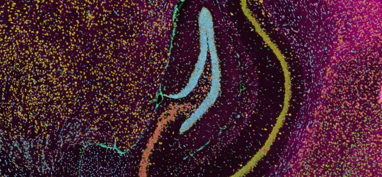 xenium mouse brain image